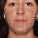 Ασπίδα προστασίας στόματος και μύτης ELEGANT 000-10-002